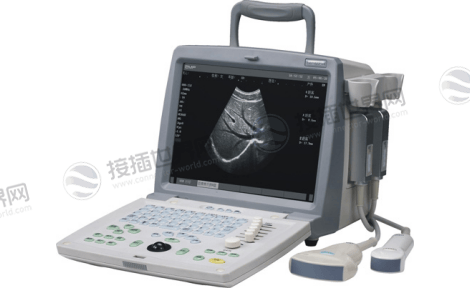 便携式超声仪